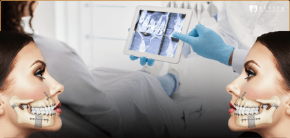 What Is Maxillofacial Surgery? Conditions, Procedures & Recovery