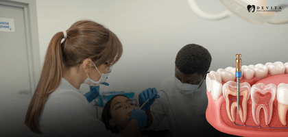 Root Canal Treatment Cost in Bangalore: Complete Price Guide (2026) 