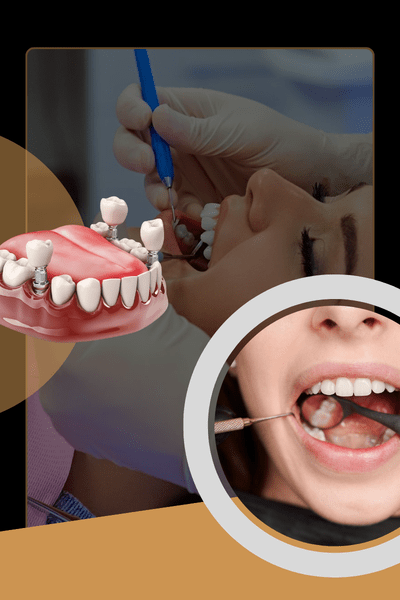 Can You Get a Dental Implant Immediately After Tooth Extraction? What You Need to Know