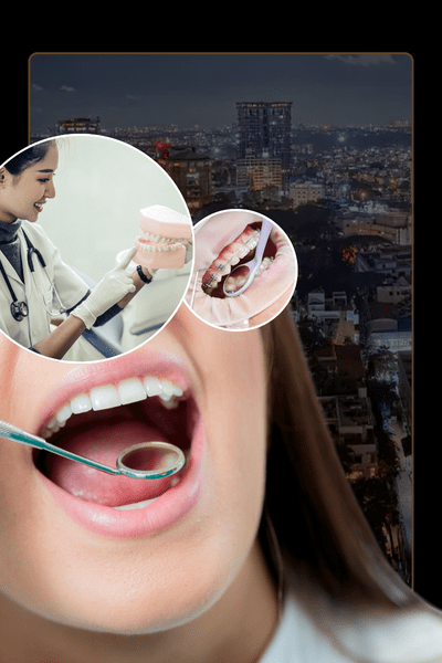 Full Mouth Rehabilitation in Bangalore: Who Needs It and What the Process Involves