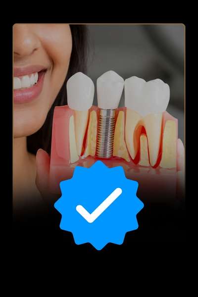 Single tooth implant and full mouth dental implants in Bangalore explained
