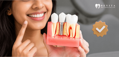 Single Tooth Implant or Full Mouth Dental Implants: Which Option Is Right for You? 