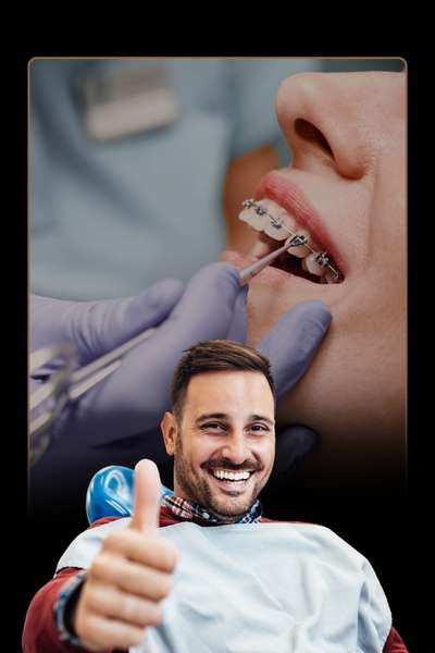Braces Cost in Bangalore: Metal, Ceramic and Other Options Explained