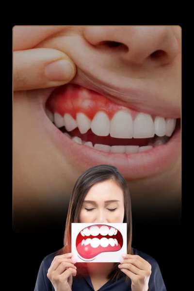 Gum Disease Treatment in Bangalore: Gingivitis, Periodontitis & Treatment Options